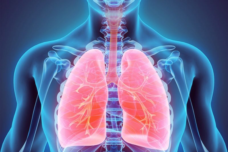 Early stage lung cancer may be detected from a drop of blood