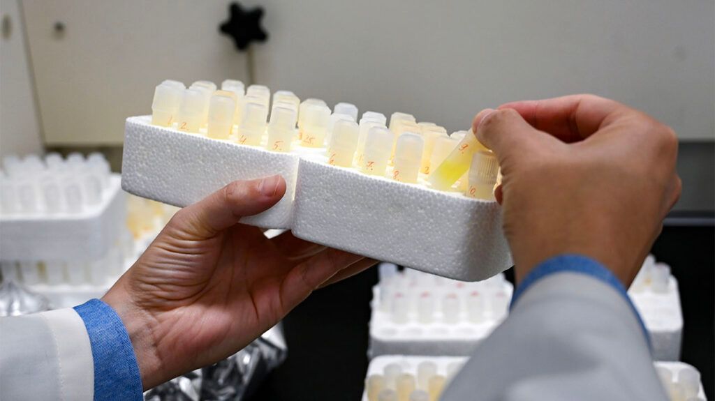 Alzheimer's is linked to low brain lithium levels, study shows