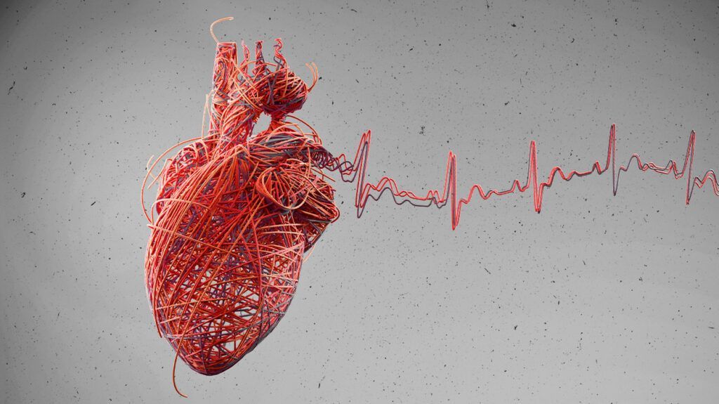 Heart attacks may be linked to bacterial infections, study finds