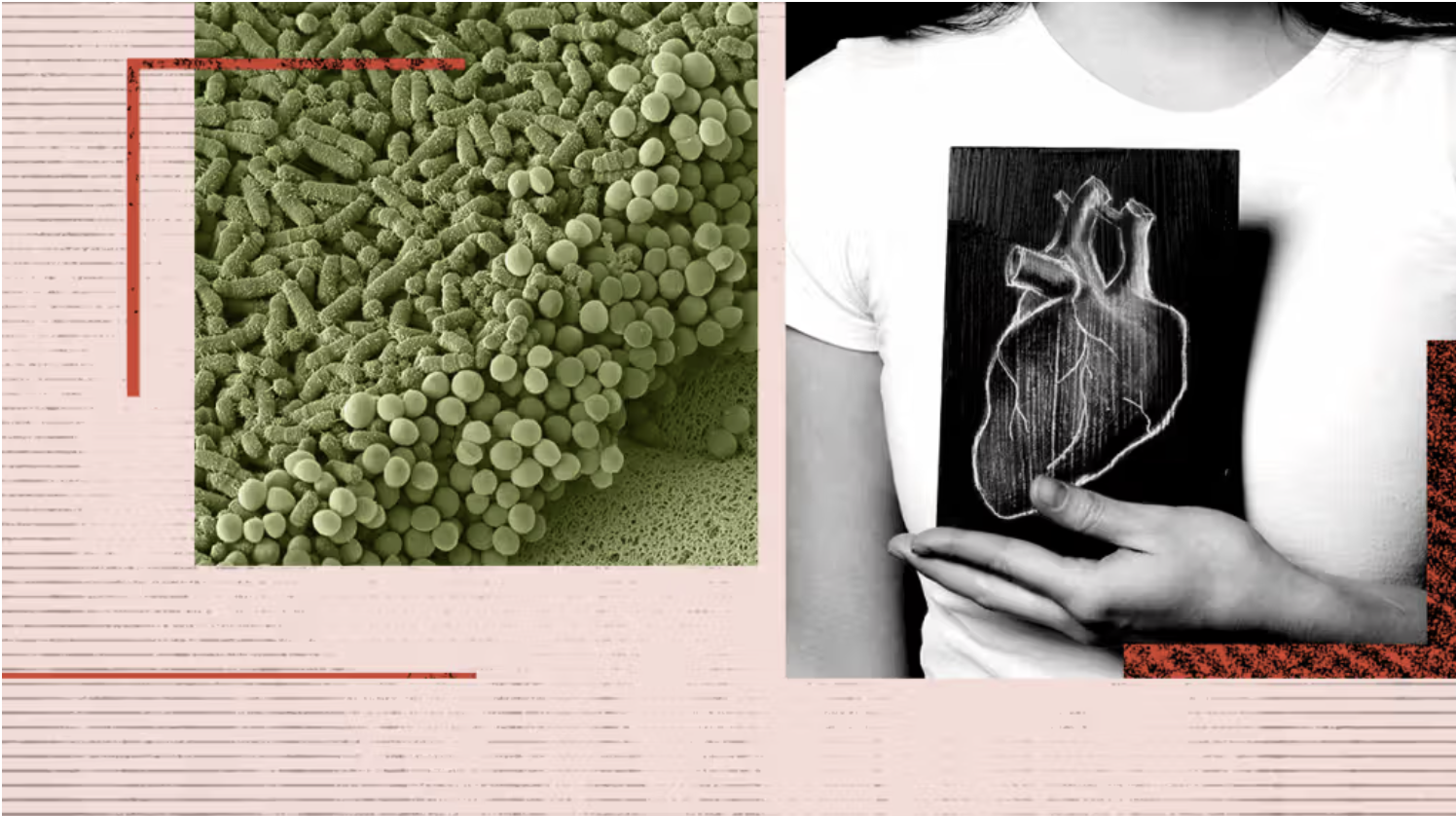 Changes in gut bacteria may be a warning sign of heart disease