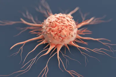 研究呼吁：阿育曼·巴拉特计划需扩大癌症覆盖范围并加强早期诊断