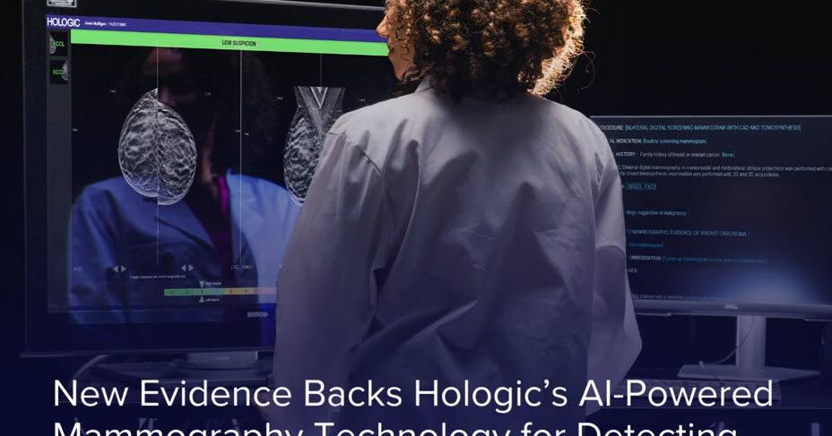 新证据支持Hologic AI乳腺摄影技术，助力检测高难度癌症